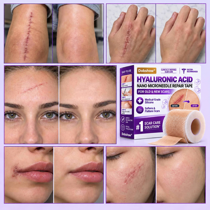 Medical-Grade Nano Microneedle Scar Repair Tape: Targeted Scar Care For Surgical, C-Section, Raised & Stubborn Scars