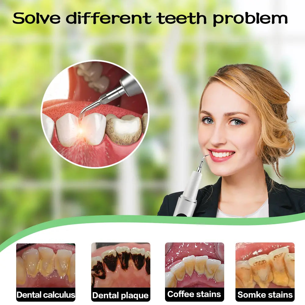 Electric Tartar Remover for Teeth with LED Light