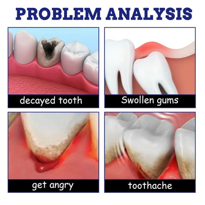 Oral Care Spray - Mouth Care Solution for Quick-Acting Toothache Relief